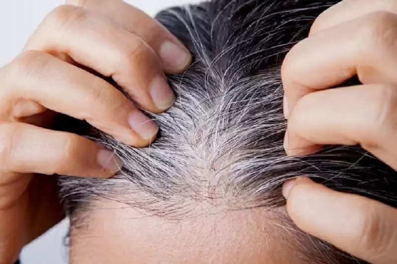 Home Remedies For Grey Hair  10 Ayurvedic Methods  Kama Ayurveda