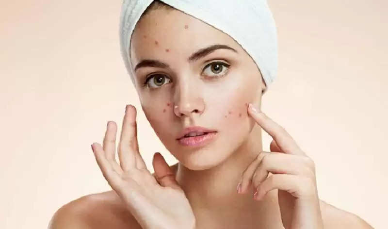 beauty-tips-remove-dark-spots-on-the-face-with-the-help-of-these-home