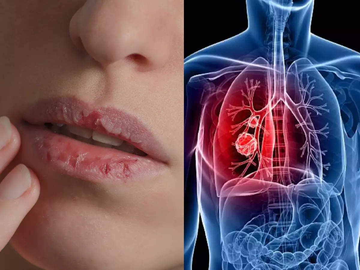 know-why-does-pneumonia-happen-and-how-serious-is-it