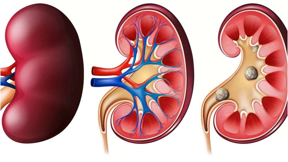 kidney-health-do-not-ignore-the-problem-of-weak-kidney-adopt-this